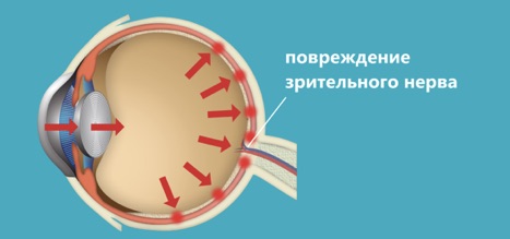 Статья: Жизнь под давлением