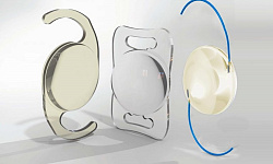 Интраокулярные линзы (ИОЛ) - искусственный хрусталик