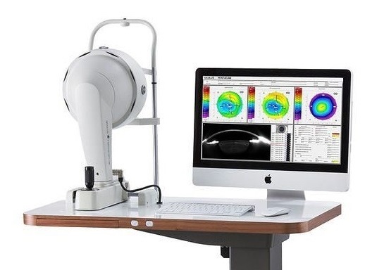 Диагностика кератоконуса на аппарате Пентакам
